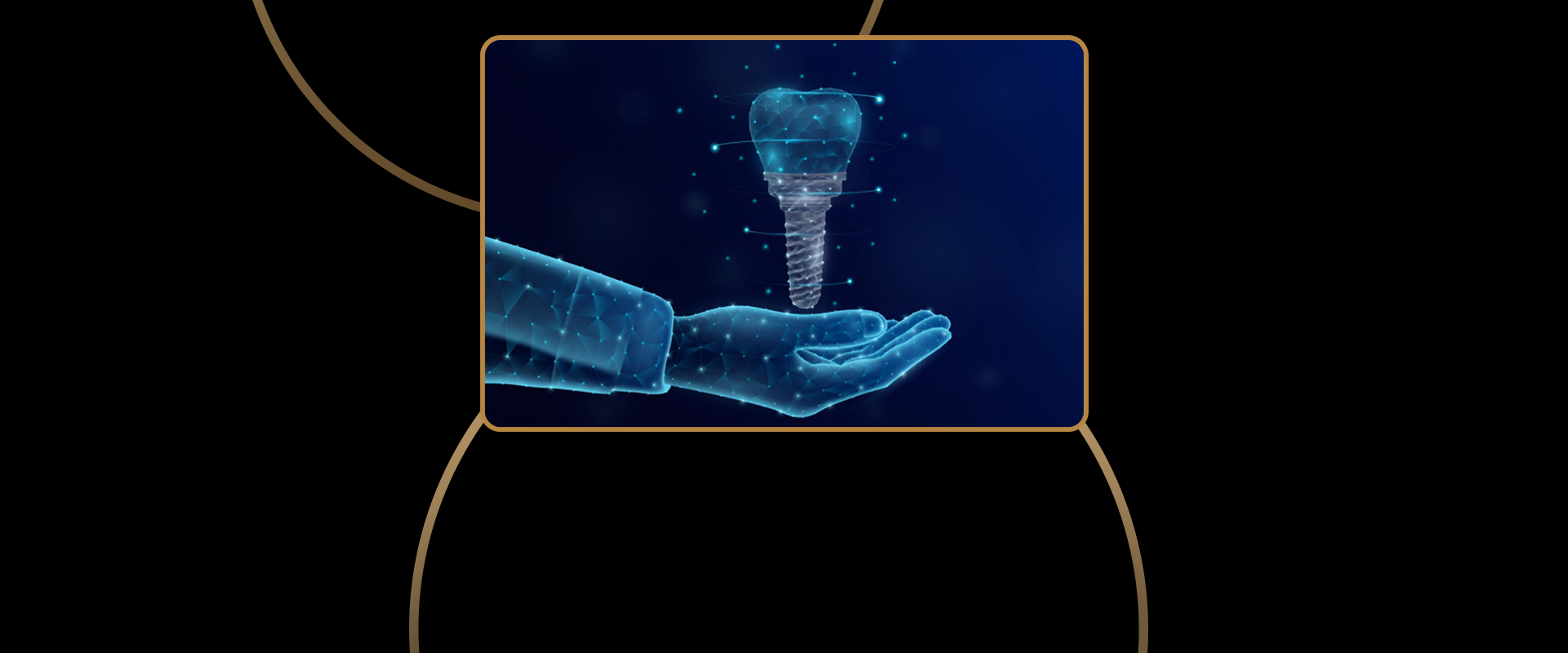 Dental Implant Technology